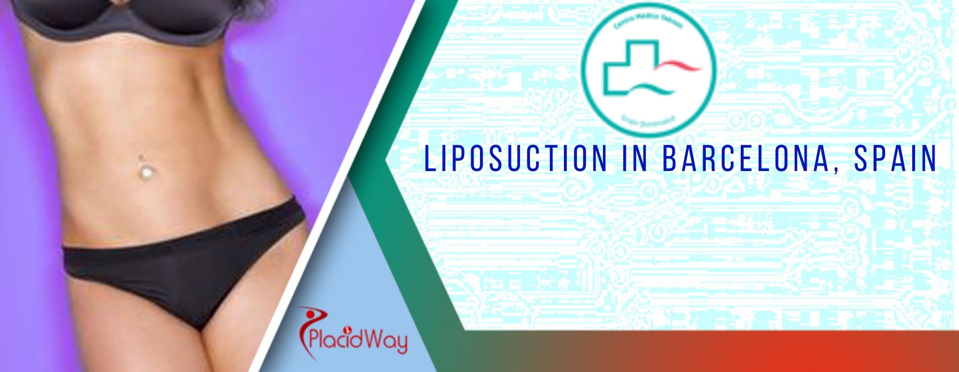 Liposuction in Barcelona, Spain Liposuction in Barcelona, Spain